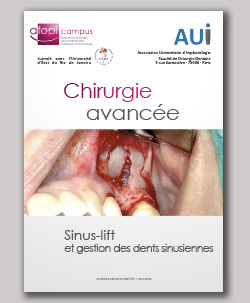 livret du Cours de Chirurgie Avancée - Sinus Lift